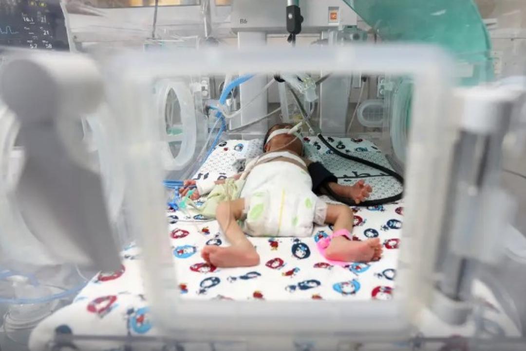 Taxa de nascimentos prematuros do Brasil está acima da média global